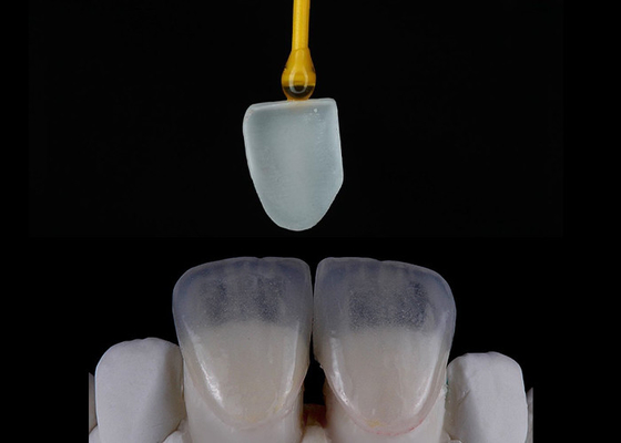 Harga yang bagus Custom Made Restorasi Gigi EMAX veneers indah selaras Digital Impression on line