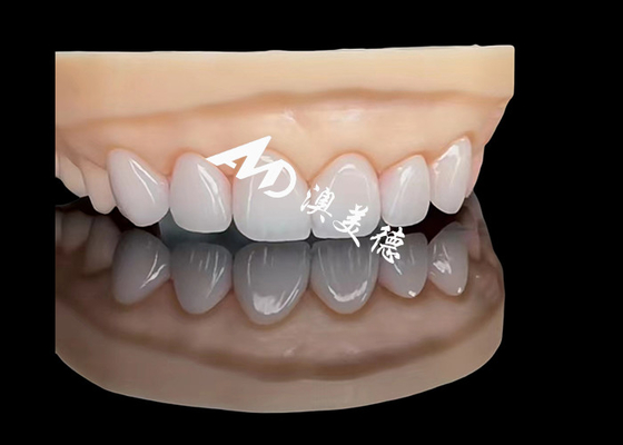 Harga yang bagus Porselen EMAX Veneer Perbaikan Estetika Presisi Tinggi dengan Ketahanan Tinggi on line