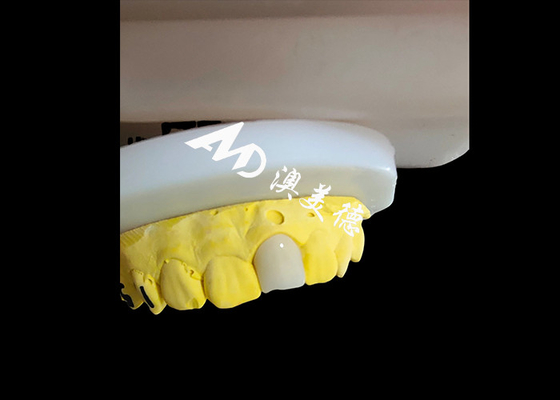 Harga yang bagus Natural Looking Aesthetic Zirconia Dental Crown Flawless Fit Restorasi Gigi on line