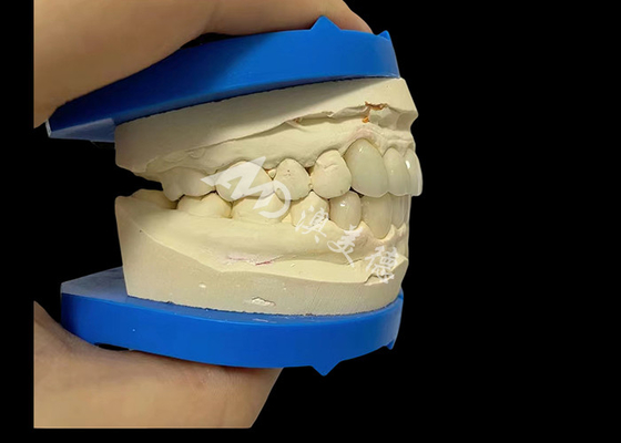 Harga yang bagus Kekuatan yang tak tertandingi Dental Zirconia Dentla Crown Untuk Senyum yang terlihat alami on line