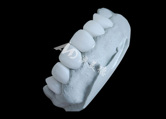 Harga yang bagus Zirconia dental crown memberikan kekuatan tak tertandingi dan kehalusan alami, dan translucence alami on line