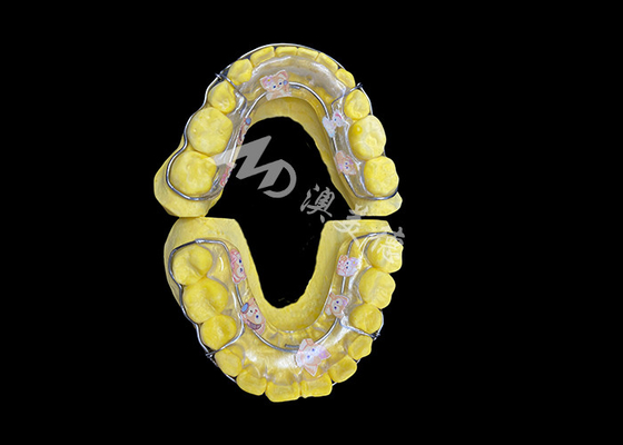Harga yang bagus Beagle Retainer untuk Retensi Senyum yang Efektif dan Penyusunan yang Lama on line