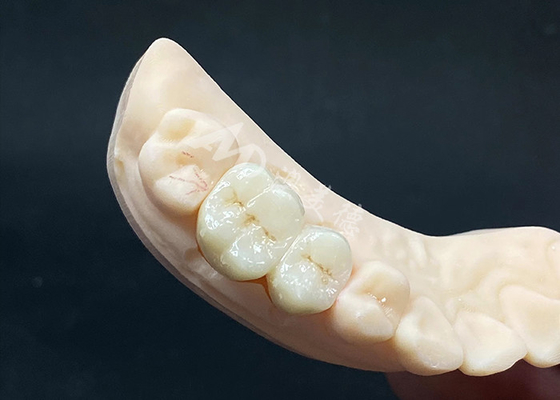 Harga yang bagus High Translucency Zirconia Crown Desain terlihat alami dengan ketahanan puing on line