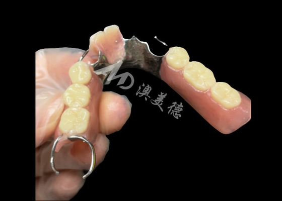 Harga yang bagus Titanium Cast Partial Denture Dengan Klep Duduk Bersama Gigi on line