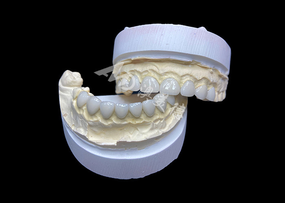 Harga yang bagus Disesuaikan Ultra Thin Glass Ceramic Veneers Translucence Tinggi untuk Senyum Alami on line