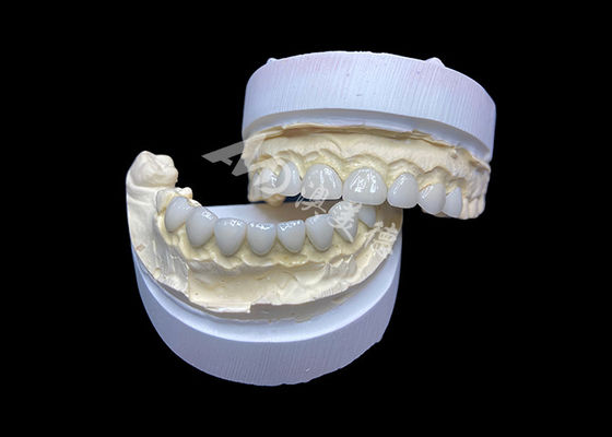 Harga yang bagus Kustomisasi Veneer Keramik Kaca Ultra Tipis Translusensi Tinggi on line