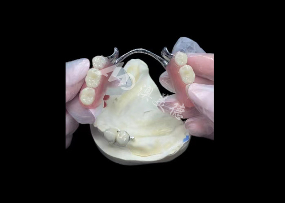 Harga yang bagus Porselen tahan lama yang dilebur ke logam Dental Crown PFM Crown Untuk Restorasi on line