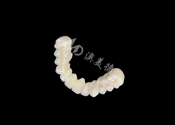 Harga yang bagus Pengikat jangka panjang PFM Dental Crown Bridge Dengan Biokompatibilitas yang sangat baik Pengikat Aman on line