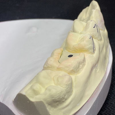 Harga yang bagus Perkuat Pemulihan Anda dengan Teknologi Inti Pasak Merah Muda Lock on line