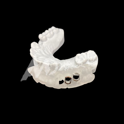 Harga yang bagus Panduan Implantasi Bedah Cetak 3D yang Tepat dengan Ketahanan Tinggi terhadap Perubahan Warna Menggunakan Teknologi Penggilingan CAD/CAM on line