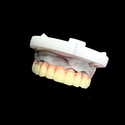Harga yang bagus Zirconia Porcelain Dental Crown CAD/CAM Precision Natural-Looking Aesthetic Finish ISO13485 Bersertifikat On line