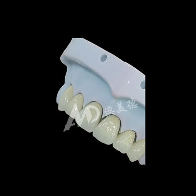 Harga yang bagus Full Contour Monolithic Zirconia Dental Crown On line